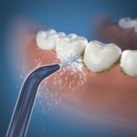 Прецизійна насадка Waterpik з низьким потоком JT-360E - Зображення 3
