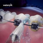 Ортодонтичні насадки Waterpik OD-100E - Зображення 3