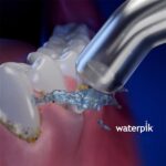 Пародонтичні насадки Waterpik Pik Pocket PP-70E - Зображення 3
